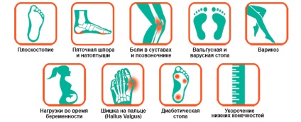 branțuri ortopedice individuale la comanda - orteze din București (de fabricație de tălpi interioare) branțuri ortopedice individuale la comanda - orteze in Bucuresti
