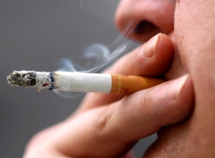 Pot fuma după o extracție dentară (fum) Pot să fumez după extracția dentară