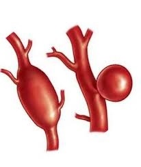 Angiografia RMN a vaselor cerebrale (care sunt procedurile de angiografie IRM) angiografia RMN a vaselor cerebrale