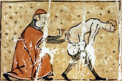 Medicina Medieval 10 metode dureroase de tratament (de păcatele tale) Medieval Medicina 10 metode dureroase de tratament