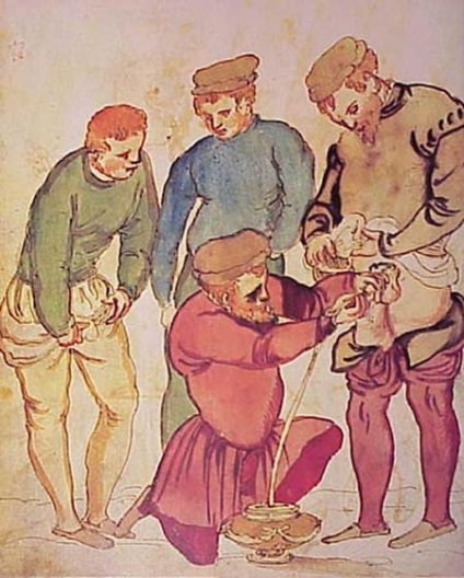 medicina medievală 10 de vindecare metode dureroase (vindecare) Medieval Medicina 10 metode dureroase de tratament