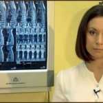 Varicela simptomelor adulți și tratament (varicela) Varicela simptomelor adulți și tratament