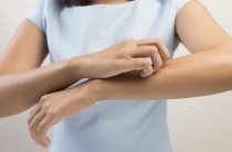 Eczeme pe mâinile unui adult arata ca, o fotografie, principalele tipuri de tratament (mâini) Eczeme pe mâinile unui adult arata ca, o fotografie, principalele tipuri de tratament