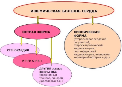 Simptomele bolii coronariene, diagnostic diferențial, tratament, semnele timpurii ale bolii coronariene