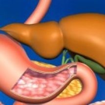 RMN și CT a abdomenului