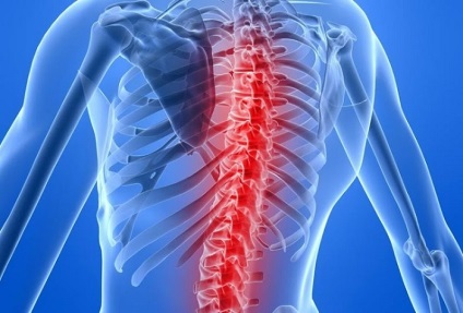 Гръбначния инсулт, или гръбначния мозък инсулт какво е, симптоми, лечение