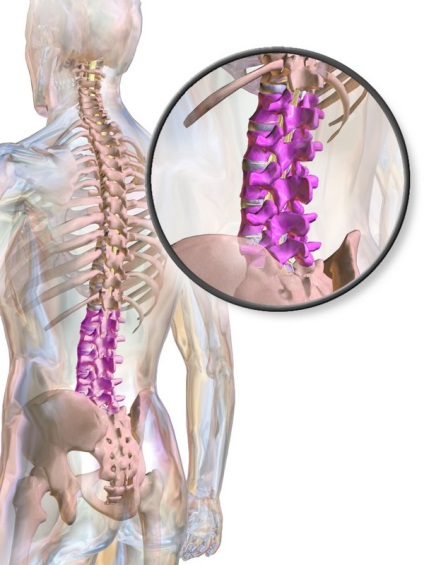 Стеноза на гръбначния стълб, общо, средно, дегенеративно