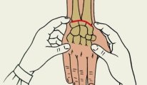 Structura articulatiilor umane de clasificare și caracteristicile acestora