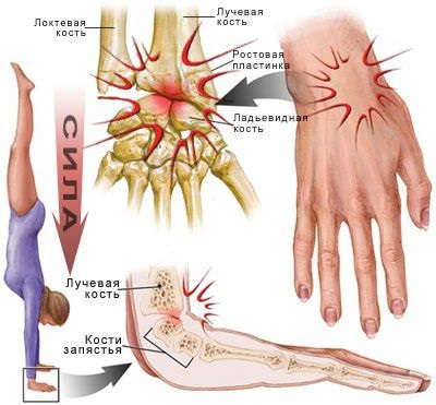 Wrist structură comună (anatomie), funcția și boala