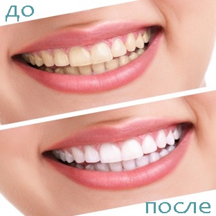 Servicii stomatologice Soci, Adler (Adler Sochi cariilor dentare stomatologie copii Dentistrys liber protezele dentare scaun medic dentist implant dentar durere) Servicii stomatologice Soci, Adler
