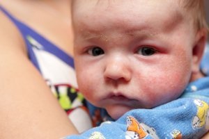 Fructe fructoza de zahăr, care este, dauna sau de beneficii pentru organismul uman, ea are corpul (fructoza) Fructe fructoza de zahăr, care este, prejudicii sau beneficii pentru organismul uman îl poartă
