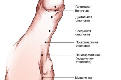 Cauzele hipospadias, tratament, complicații, profilaxia (uretrală orificiu) cauze hipospadias, tratament, complicații, prevenirea