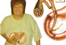 Cum se determina calculi biliari (determinat) Cum de a identifica calculi biliari