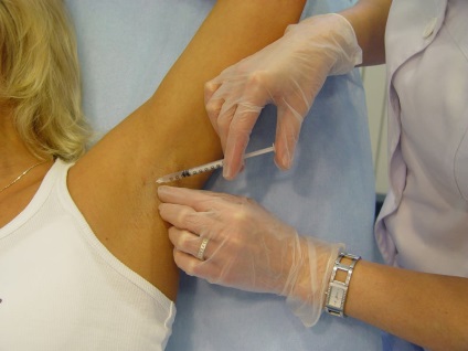Tratamentul hiperhidrozei chirurgicale si tehnici cosmetice (preturi tratament hiperhidroză) Tratamentul hiperhidroză tehnicilor chirurgicale si cosmetice