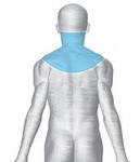hernie intervertebral (hernie) hernie intervertebral