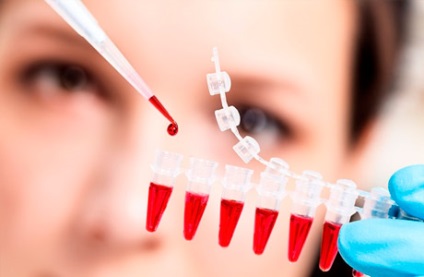 Neutropenie la sugari cunoscute forme și riscuri (grudnichka) Neutropenia la sugari cunoscute forme și riscuri