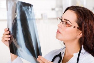 fibroza focală a plămânilor că aceasta este, de tratament al schimbărilor locale, simptome si diagnostic (simptome) fibroza focală a plămânilor că aceasta este, de tratament al schimbărilor locale, simptome si diagnostic