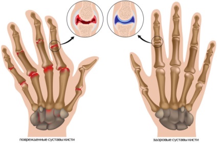 hands raze X, diagnostic, contra (contra) mâinile cu raze X, diagnostic, contra