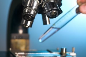 sarcomul pielii, caracteristicile și proiecțiile sale (ale pielii) sarcomul pielii, caracteristici și previziunile sale