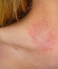 Sulf - o piele minerală frumos, păr sănătos și unghii (sănătos) Sulf - o piele minerală frumos, păr sănătos și unghiile