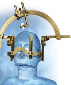 Tumorile cerebrale stereotactica biopsie, tehnologie avansată, site-ul oficial al ziarului (cap) Tumorile cerebrale stereotactica biopsie, tehnologie avansată, site-ul oficial al ziarului
