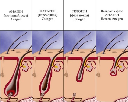 alopecie telogen, care este cauza si tratamentul bolii (cauza) alopecie telogen, care este cauza și tratamentul bolii