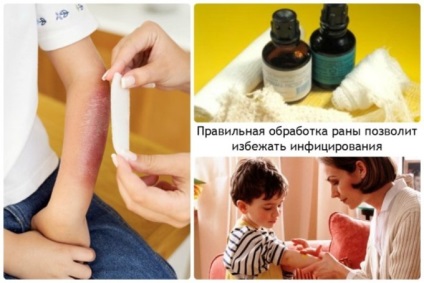 A învăța să distingă (organism vizibil atât de mici) să învețe să distingă