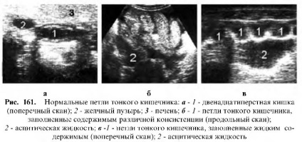 Uzi tractului gastrointestinal (gastrointestinal) Uzi tractului gastro-intestinal