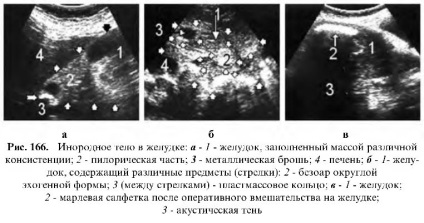Uzi tractului gastrointestinal (gastrointestinal) Uzi tractului gastro-intestinal