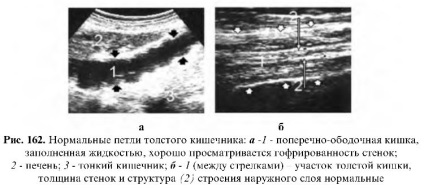 gastrointestinal Uzi (tract) Uzi tractului gastro-intestinal