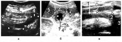 Uzi tractului gastrointestinal (gastrointestinal) Uzi tractului gastro-intestinal