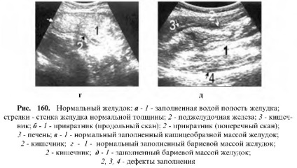 Uzi tractului gastrointestinal (cantitate mare de lichid) Uzi tractului gastro-intestinal