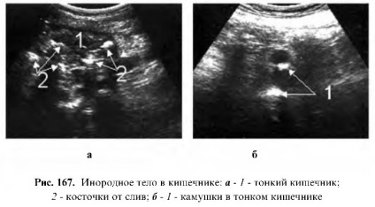 Uzi tractului gastrointestinal (gastrointestinal) Uzi tractului gastro-intestinal