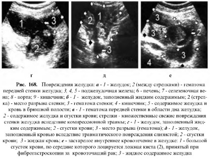 Uzi tractului gastrointestinal (gastrointestinal) Uzi tractului gastro-intestinal