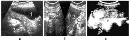 Uzi tractului gastro-intestinal (partea antrală a stomacului) Uzi tractului gastro-intestinal