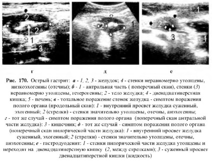Uzi tractului gastrointestinal (gastrointestinal) Uzi tractului gastro-intestinal