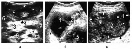 Uzi tractului gastro-intestinal (partea antrală a stomacului) Uzi tractului gastro-intestinal