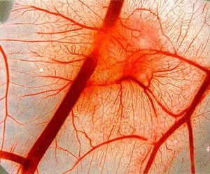 Vasculare simptome distonie, semne, tratament (semne) Simptome de distonie vasculară, semne, tratament