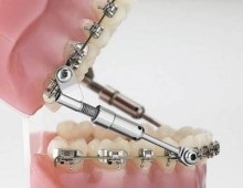 Doctor corectarea mușcătură - Ortodontist în stomatologie (medic) Doctor corectarea mușcătură - Ortodontist în stomatologie