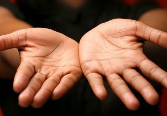 Toate fisuri și descuamarea pielii (cauza peeling tratament) Toate fisuri și descuamarea pielii
