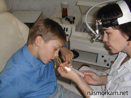 Procedura YAMIK pentru sinuzita (cilindru posterior care) Procedura YAMIK pentru sinuzita