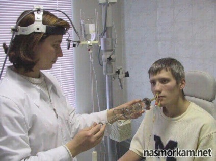 Procedura YAMIK cu sinuzita (cateter sinus YAMIK 3) Procedura YAMIK pentru sinuzita