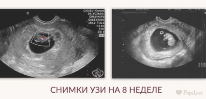 8 săptămâni gravidă - fotografii burtă, dimensiunea fatului, nutriție și sfaturi (abdomen) 8 săptămâni gravidă - fotografii burtă, dimensiunea fatului, mese si sfaturi