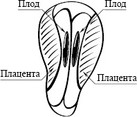 Și dacă am gemeni (tripleti)