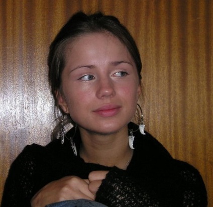 Alex contur de buze de plastic rinoplastie și cântăreț, foto înainte și după (Alex înainte și după Rinoplastia) Alex contur buze de plastic și cântăreață rinoplastie, fotografii înainte și după
