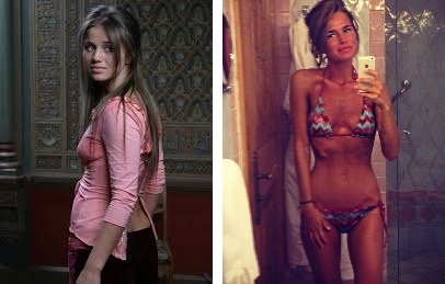 Alex contur de buze de plastic rinoplastie și cântăreț, înainte și după fotografii (fotografii) Alex contur buze de plastic și cântăreață rinoplastie, fotografii înainte și după