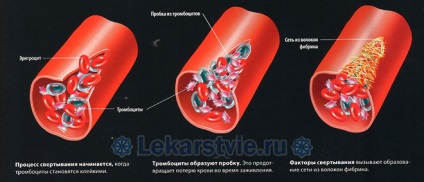 Lista Anticoagulantele de medicamente din noua generație de acțiune directă (medicamente) Lista Anticoagulantele de medicamente din noua generație de acțiune directă