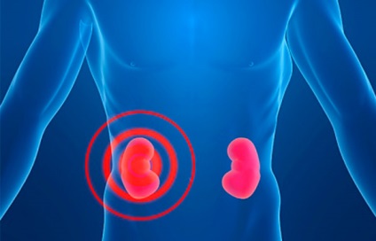 Aplazia (agenezie) cauze renale, simptome, diagnostic, tratament, competent pentru sănătate pe iLive (agenezie renală) Aplazia (agenezie) cauze renale, simptome, diagnostic, tratament, competente pentru sanatate pe ilive