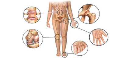 Artrologie, meddoc (meddoc) Artrologie, meddoc