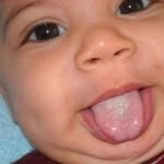 acoperire limba albă la sugari cum se curăță și se îndepărtează (alb) acoperire limba albă la sugari cum pentru a curăța și elimina